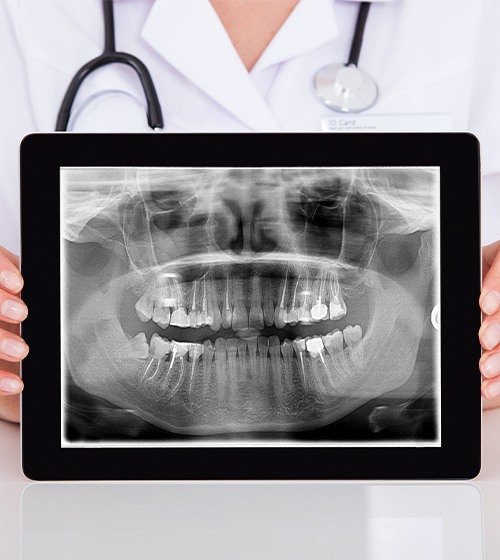 Dental x-rays on tablet computer