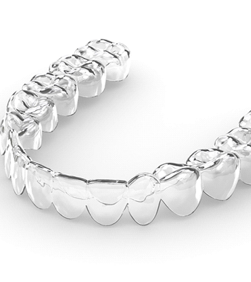 a computer illustration of a pair of Invisalign aligners