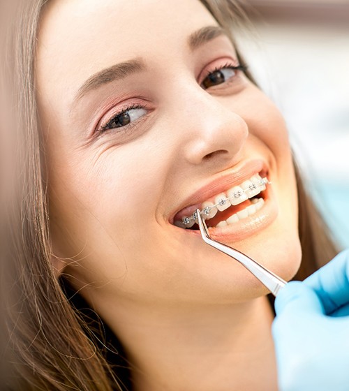 An orthodontist adjusting the wire in a female patient’s braces