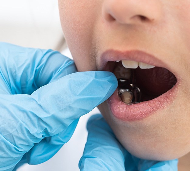 Child with an appliance