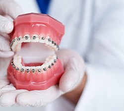 braces on fake teeth