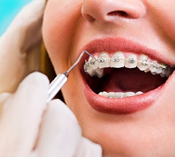 young woman visiting orthodontist