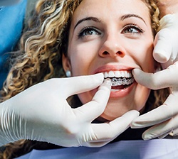 young woman getting Invisalign 