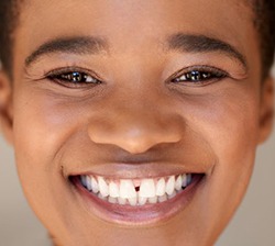 Smiling woman with gap between her front teeth