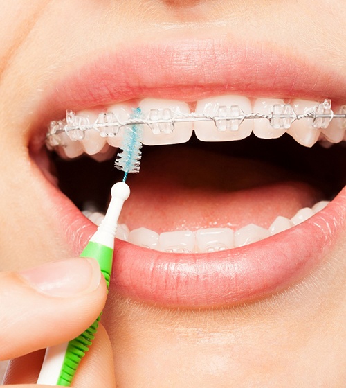 Woman cleaning her braces