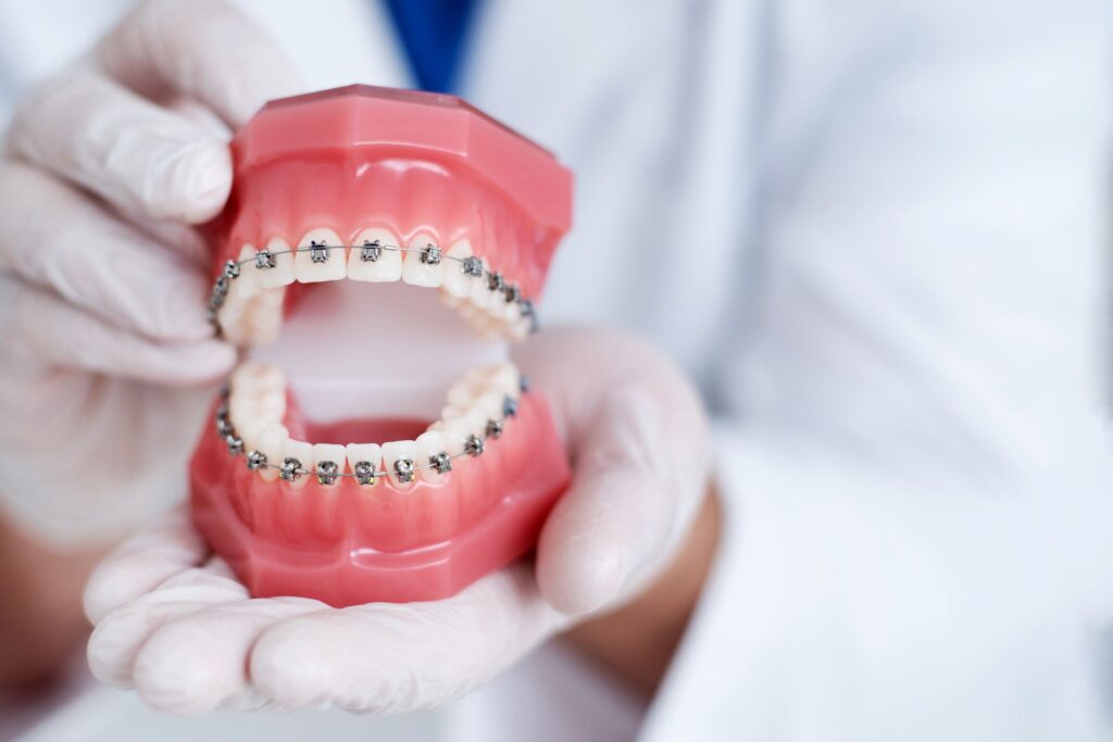 Dentist wearing white holding sample arches with model braces