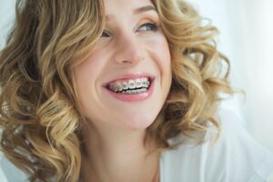 Woman smiling with braces. 